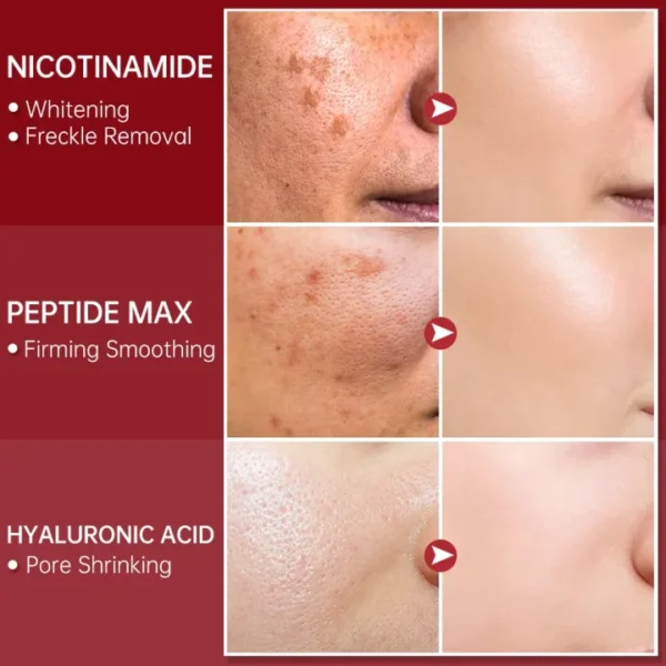 Glycolic Acid Serum for Glowing Skin