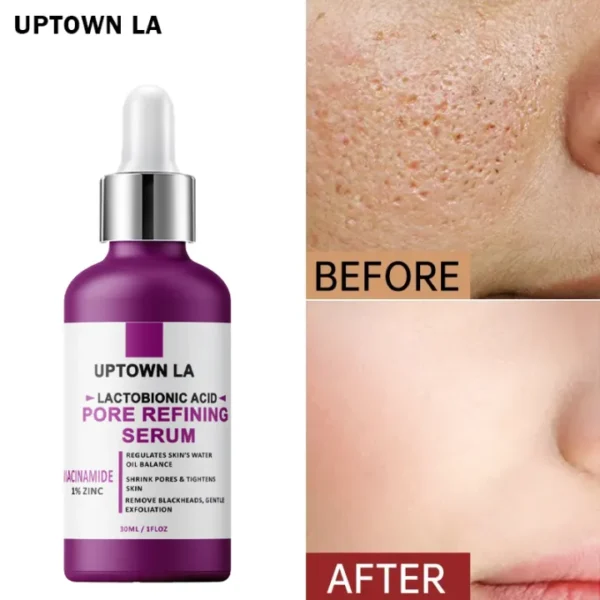 Uptown LA Pore Refining Serum