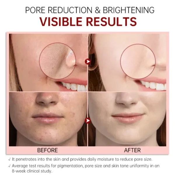 FORT PORE REFINING Serum